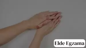 egzama nedir elde egzama
