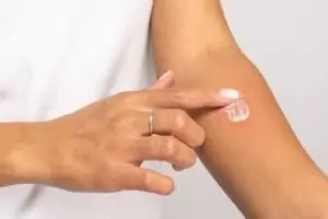 sedef hastalığı