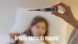 öpücük hastalığı tedavisi