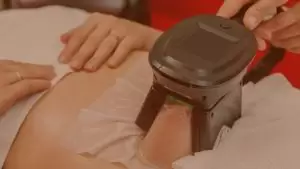 soğuk lipoliz